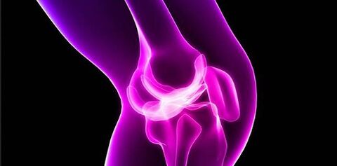Arthrose im Kniegelenk