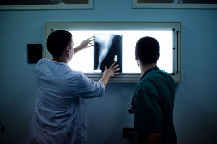 Diagnose von Arthrose am Radius x