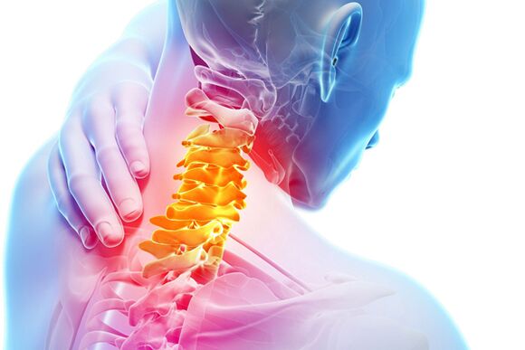 Zervikale Osteochondrose
