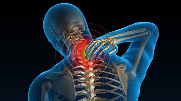 Schmerzen beim Drehen des Halses können auf ein Halswirbel-Osteochondrose-Syndrom hinweisen